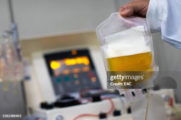 blood plasma donation during coronavirus pandemic - blood plasma stock pictures, royalty-free photos & images