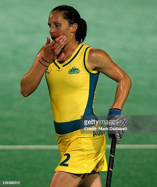 Madonna Blyth of the Hockeyroos leaves the field bleeding during the Oceania Cup match between New Zealand and Australia at Hobart Hockey Centre on...