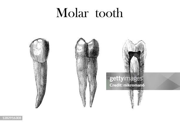 Molar Teeth Example Old Engraved Illustration Of Human Molars Teeth High-Res Stock Photo ...