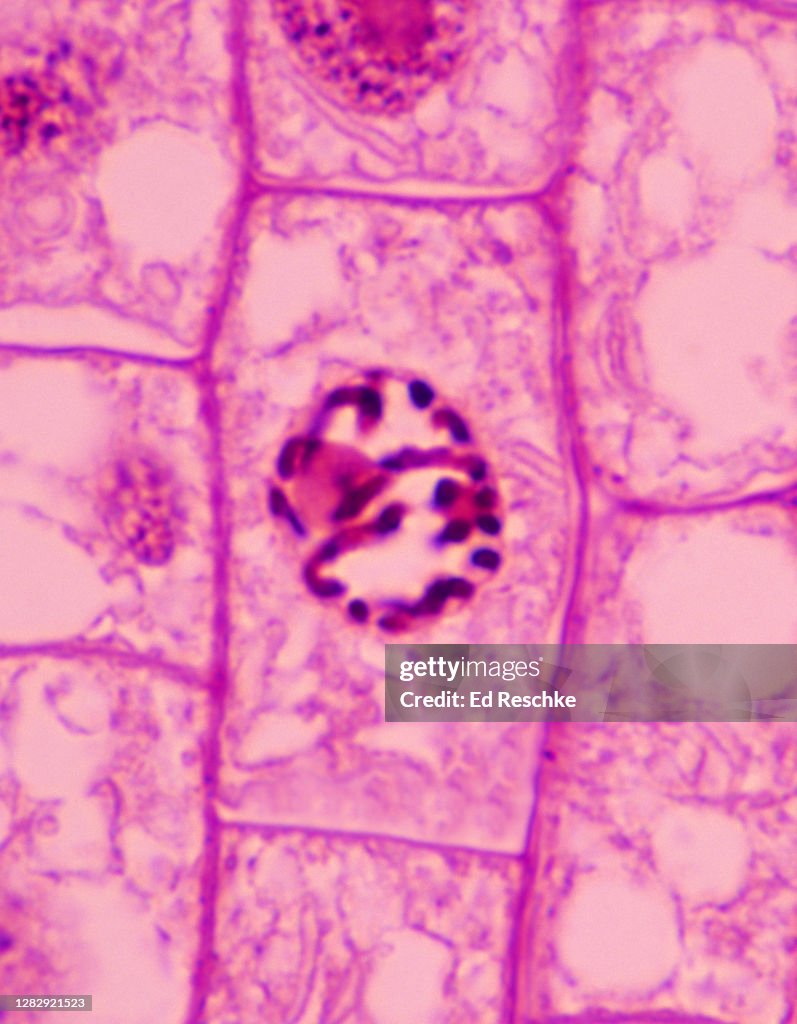 Onion Cell Mitosis Prophase