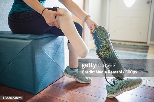 Caucasian Woman Amputee Putting On Her Prosthetic Leg,Poulsbo,Washington,United States,USA Caucasian Woman Amputee Putting On Her Prosthetic Leg,Poulsbo,Washington,United States,USA