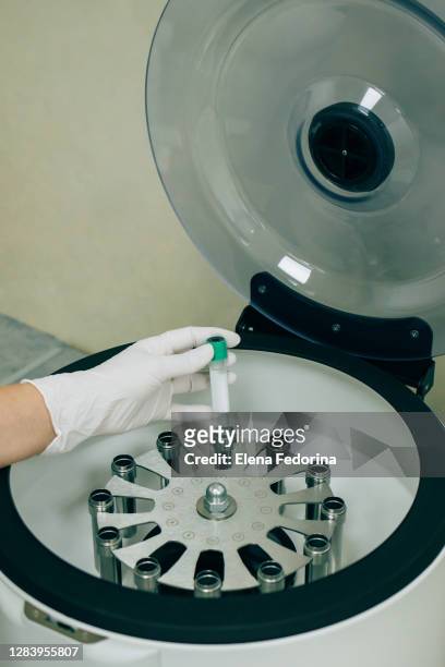 centrifuge for blood tests. - centrifugal force stockfoto's en -beelden