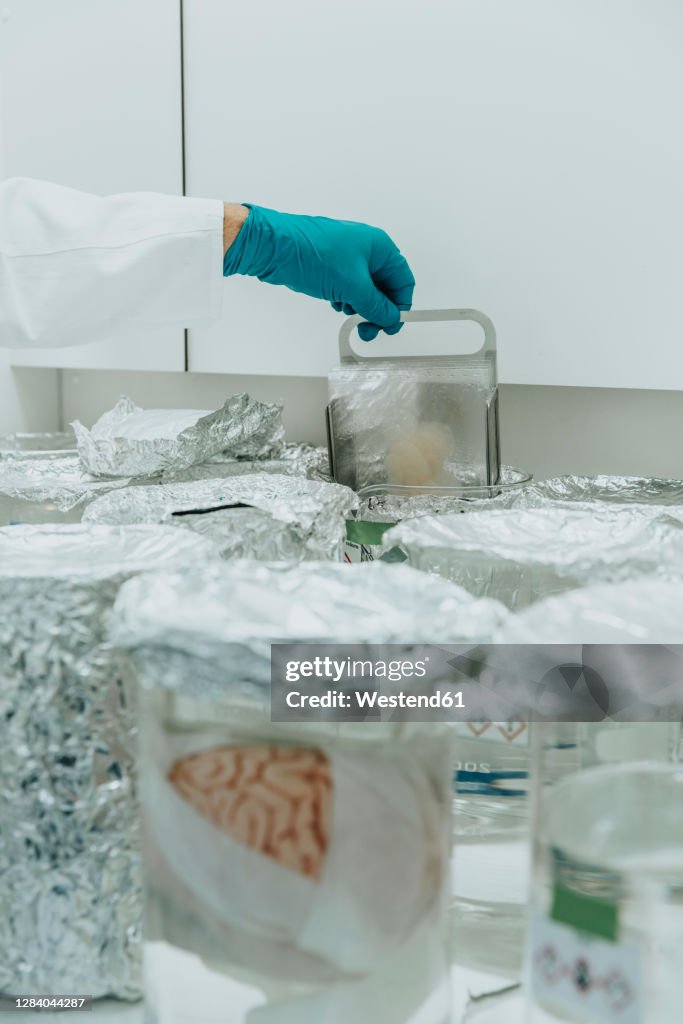 Brain Exploding Beaker Scientist Working By Preserved Human Brain Beaker At Laboratory High ...