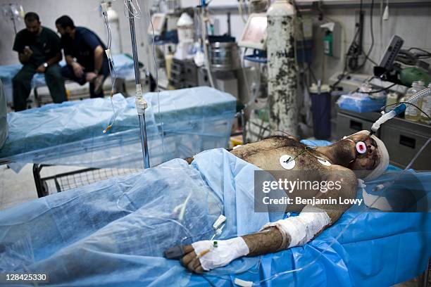 Libyan man, shot in the head, is treated at a hospital ICU ward on August 25 2011 in Tripoli, Libya.