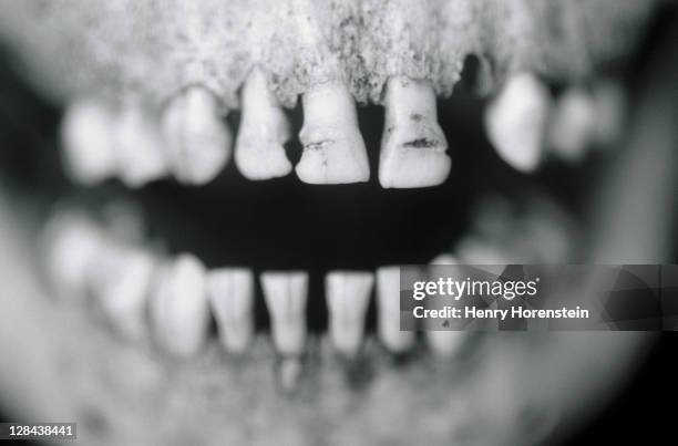 ancient male mandible - dentition humaine photos et images de collection