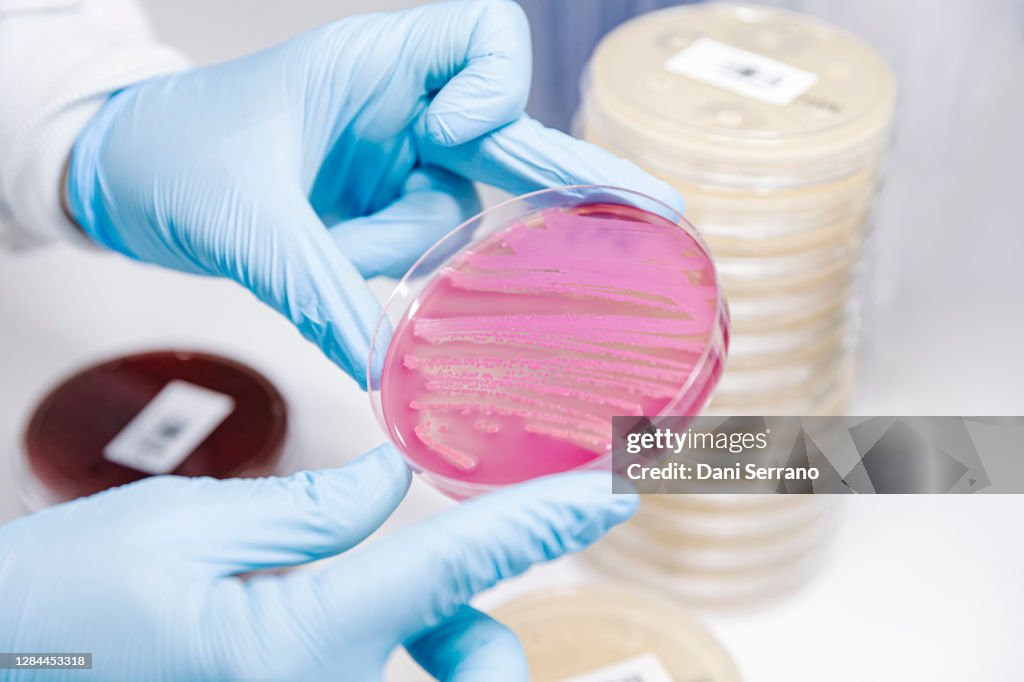 Scientist checking petri dish with microbial growth