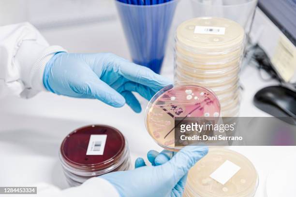 scientist checking petri dish with bacterial and fungical growth - agar jelly stock pictures, royalty-free photos & images
