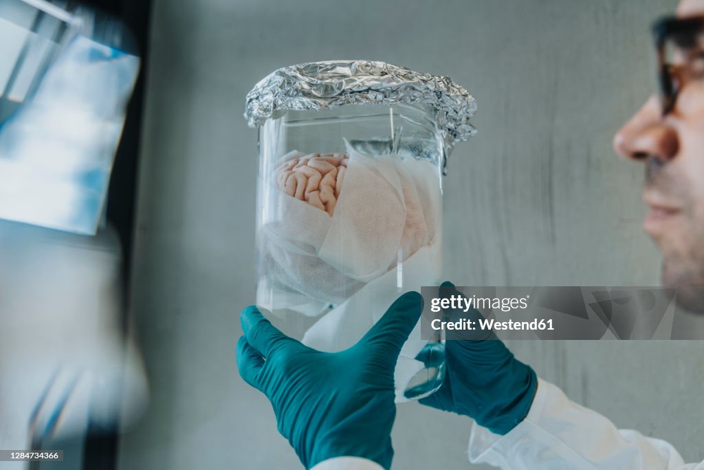 Scientist hand holding preserved human brain beaker while standing at clinic corridor
