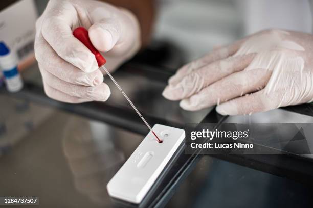 rapid test for covid-19 - rapid diagnostic test stock pictures, royalty-free photos & images