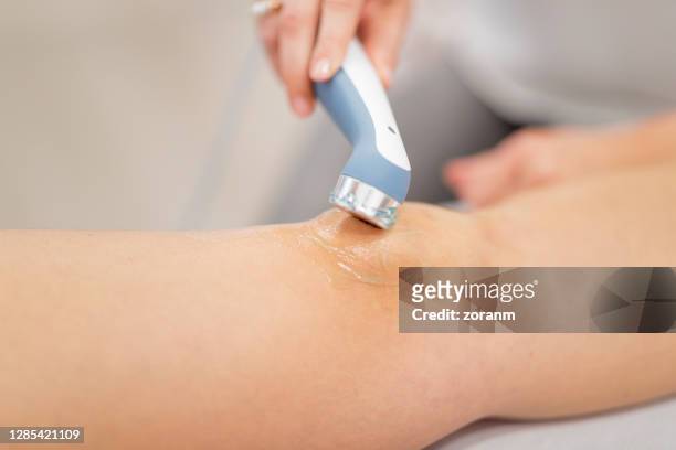 ultrasound treatment of human knee with gel applied - human knee stock pictures, royalty-free photos & images