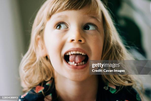 young girl with wobbly tooth pulling faces showing her tooth - baby tooth stock-fotos und bilder