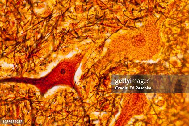 neuron cell bodies and unmyelinated nerve fibers from the gray matter of the spinal cord, 250x - spinal neuron imagens e fotografias de stock