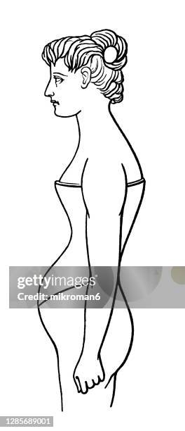 old engraved illustration of a silhouette of a female body deformed by wearing a corset - orthopedic corset stock pictures, royalty-free photos & images