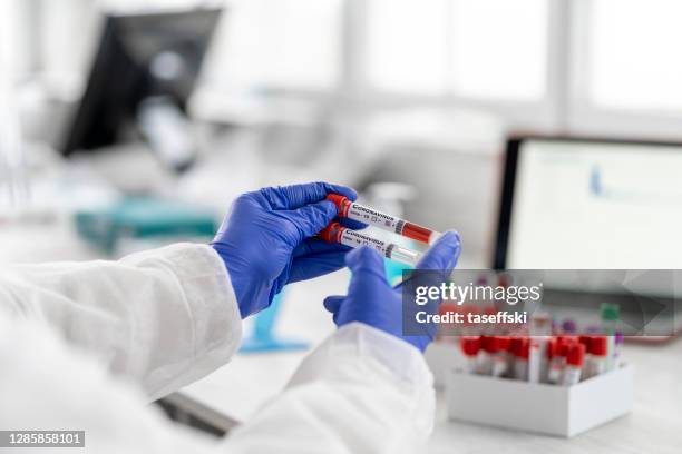 researchers working for covid vaccines - hiv prevention stock pictures, royalty-free photos & images