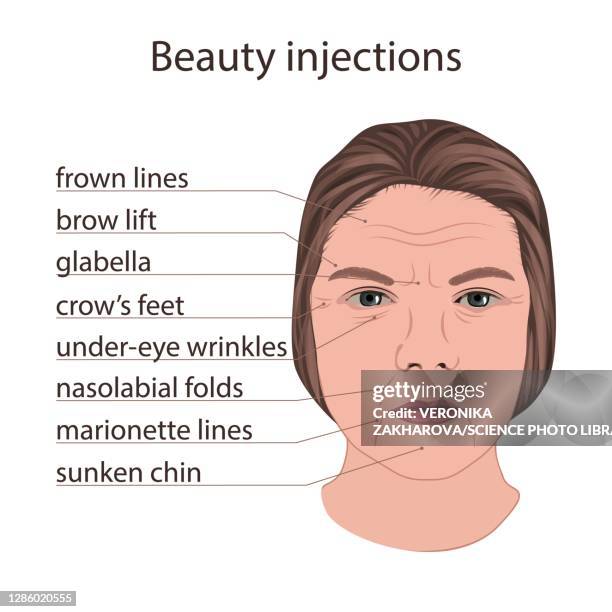 High Re Injection Neurotoxin Injection Photos and Premium High Res Pictures - Getty Images