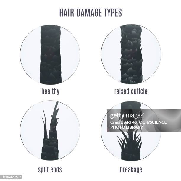 Hair Rash Type Skin Rash Types - Fotografias e Filmes do Acervo - Getty Images