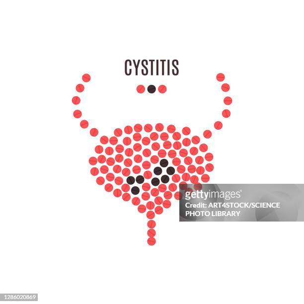 cystitis, conceptual illustration - science stock illustrations stock-grafiken, -clipart, -cartoons und -symbole