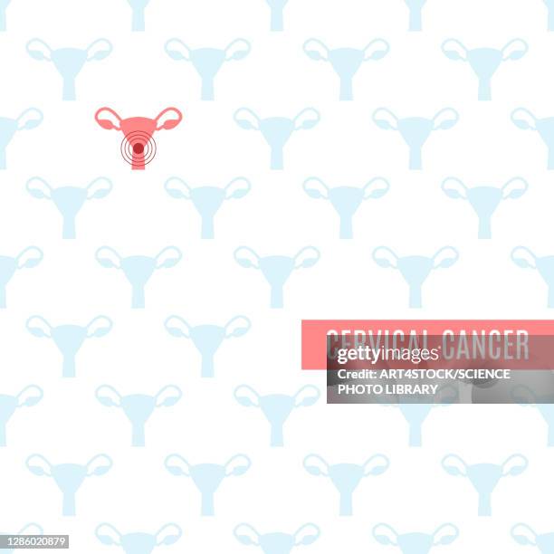 cervical cancer, conceptual illustration - gynaecological examination stock illustrations