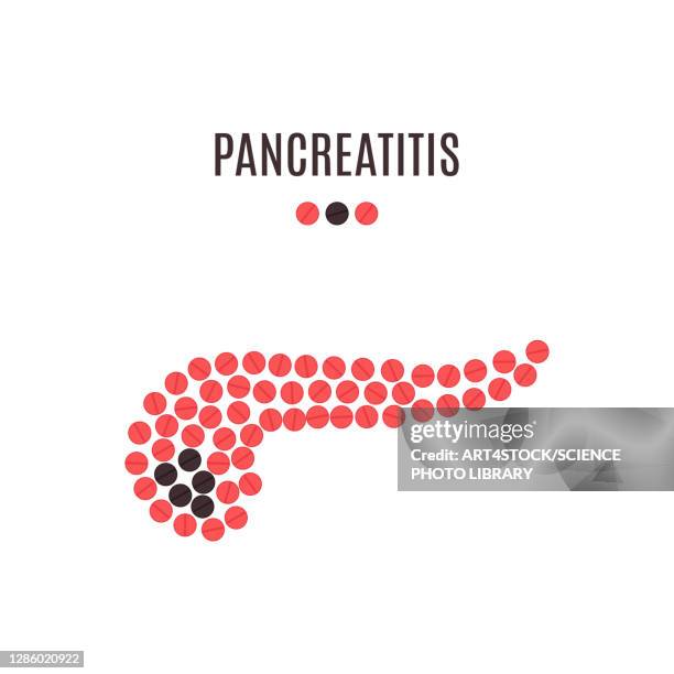 pancreatitis, conceptual illustration - chronic condition stock illustrations