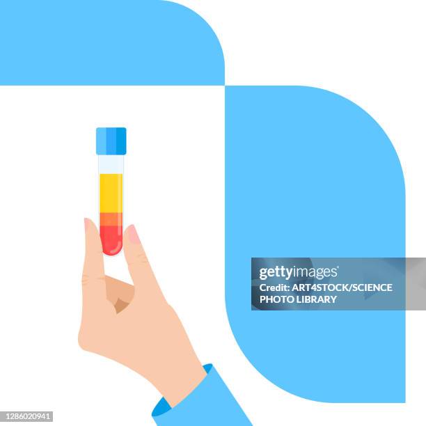 platelet rich plasma medical use, illustration - hand in hair stock-grafiken, -clipart, -cartoons und -symbole