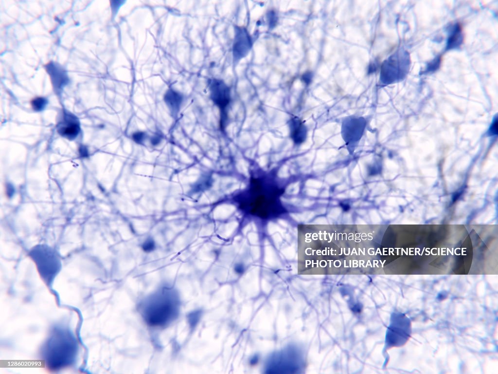 Protoplasmic astrocyte, illustration