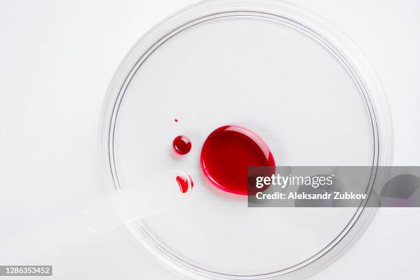 a drop of blood in a glass petri dish . - tube de prélèvement sanguin photos et images de collection