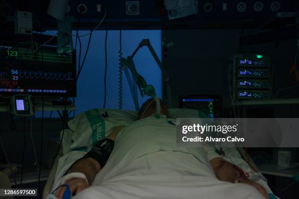 Patient infected with Covid-19 remains intubated in the ICU of the San Jorge Hospital on November 19, 2020 in Huesca, Spain. Marta Polo is an ICU...