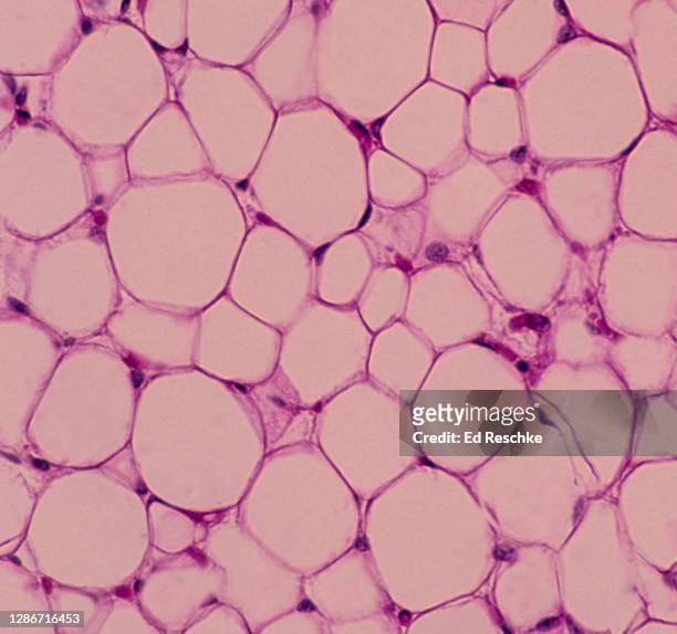 adipose tissue with numerous fat cells (adipocytes), 150x - fettgewebezelle stock-fotos und bilder