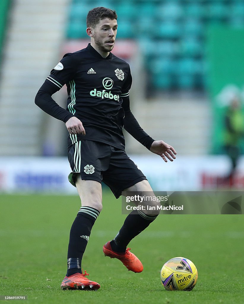 Hibernian v Celtic - Ladbrokes Scottish Premiership