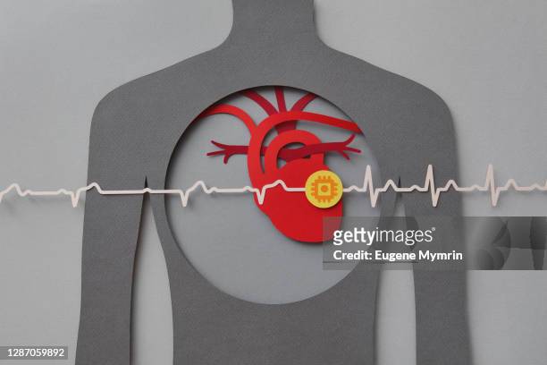 heart with pacemaker - human heart stock-fotos und bilder