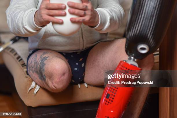 young man taking on his prosthetic leg and getting ready to his regular day - leg wound stockfoto's en -beelden