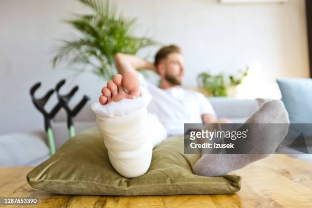 young man with broken leg using smart phone - man crutches stock pictures, royalty-free photos & images