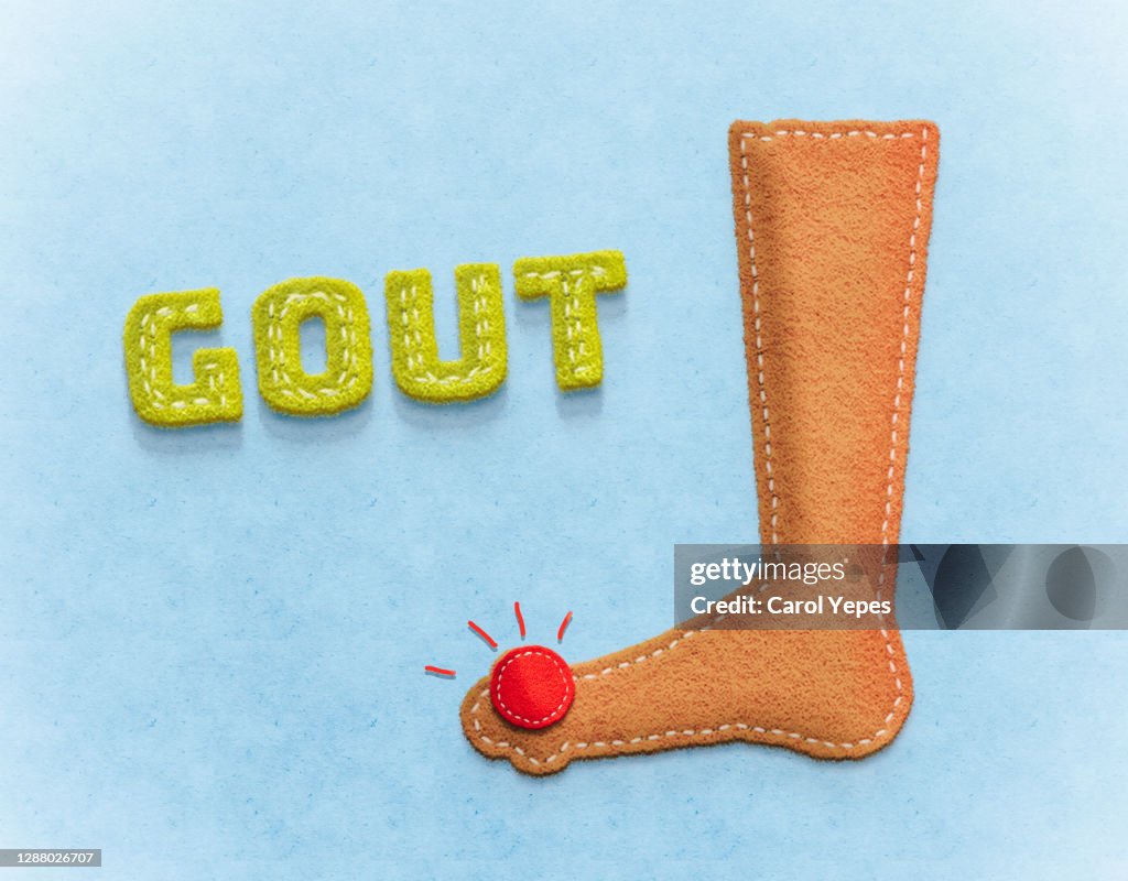 Conceptual felt imagen of gout and uric acid leves