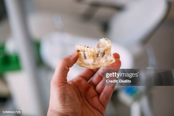 männliche hand halten dental modell - gebiss mensch zähne stock-fotos und bilder