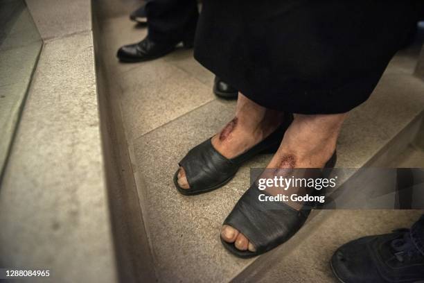 Lebanese maronite faithful Hilani Abi Khalil, who was healed from a cyst by St Charbel, carries the wounds of Jesus on her head, hands and feet.