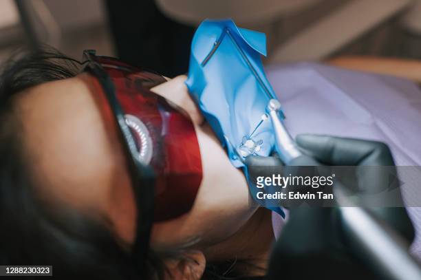 asiatische chinesische männliche zahnarzt blick durch mikroskop auf patientenzähne in zahnarztpraxis wurzelkanal behandlung - root canal procedure stock-fotos und bilder