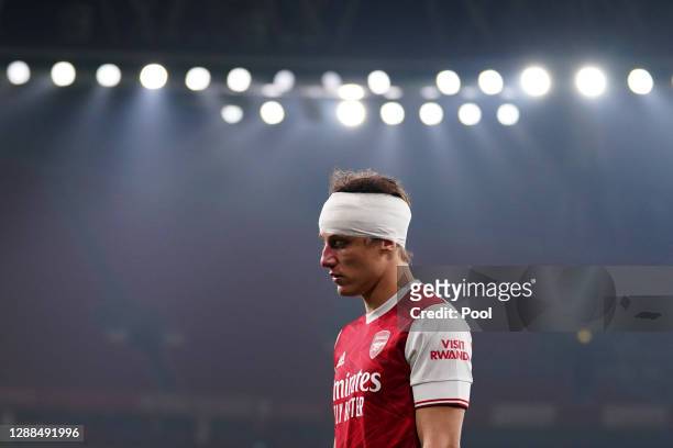 David Luiz of Arsenal looks on after a collision with Raul Jimenez of Wolverhampton Wanderers during the Premier League match between Arsenal and...