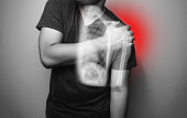 Close up Shoulder and humerus bone fracture pain in a man, Young man holding his shoulder in pain Shoulder inflammation symptoms medical healthcare concept