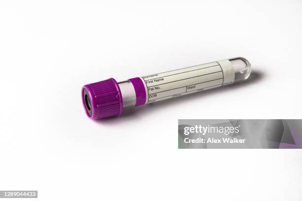 empty blood bottle on white background - tubo equipamento de laboratório - fotografias e filmes do acervo