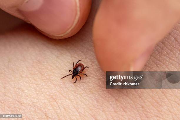 the fingers of the hand catch an encephalitis forest tick crawling on human skin. danger of insect bite and human disease - bites stockfoto's en -beelden