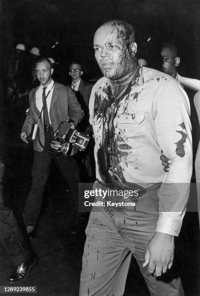 An injured man, with blood from a head wound on his face and shirt, during rioting in the Harlem neighborhood of New York City, New York, July 1964....