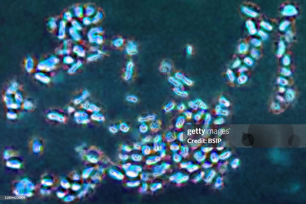 Prevotella bacteria