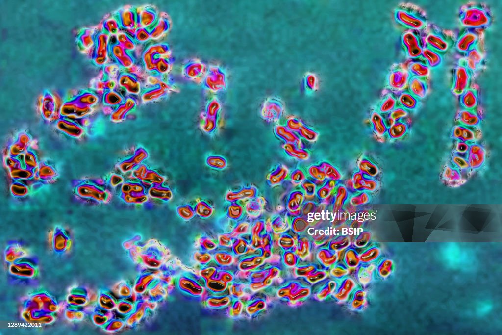 Prevotella bacteria