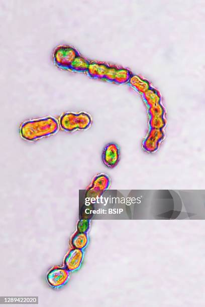 Streptococcus pyogenes bacteria, responsible for infections, including angina, bronchopulmonary infections pneumonia, infection of wounds and skin....