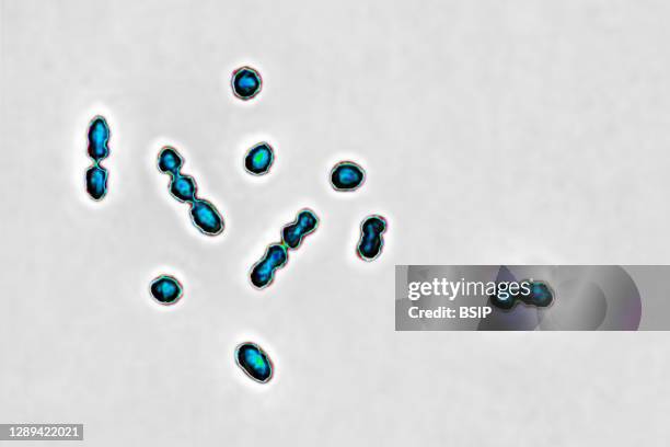 Streptococcus agalactiae bacteria, responsible for vaginal and urinary tract infections and newborn infections including meningitis and septicemia....