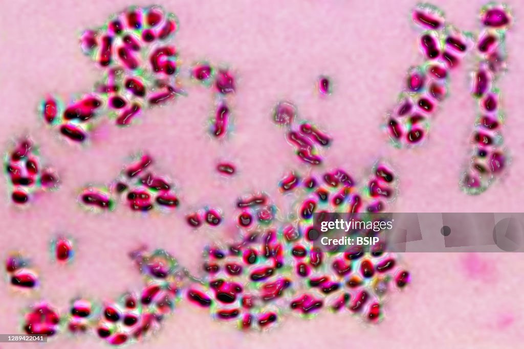 Prevotella bacteria