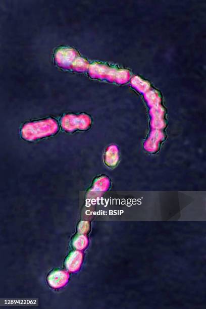 Streptococcus pyogenes bacteria, responsible for infections, including angina, bronchopulmonary infections pneumonia, infection of wounds and skin....