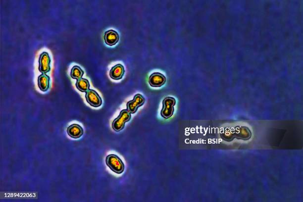 Streptococcus agalactiae bacteria, responsible for vaginal and urinary tract infections and newborn infections including meningitis and septicemia....