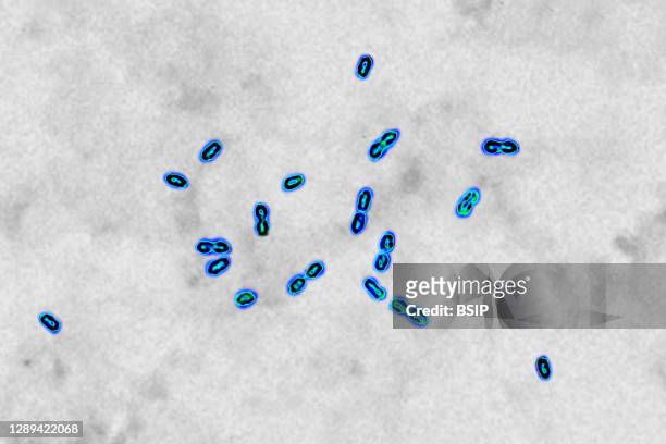 Pneumococcal bacteria . Pneumococcus is an important pathogen in humans. It is responsible for many infections . He was responsible for pneumonia...