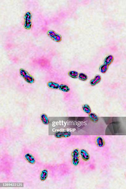 Pneumococcal bacteria . Pneumococcus is an important pathogen in humans. It is responsible for many infections . He was responsible for pneumonia...